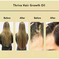 Natural Hair Growth Serum - Thrive Hair Oil